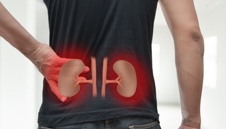 The Growing Concern of Kidney Disease Symptoms to Watch Out For