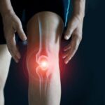 Is It Just Aches — or Early Arthritis? Early Signs of Arthritis in Your 20s and 30s