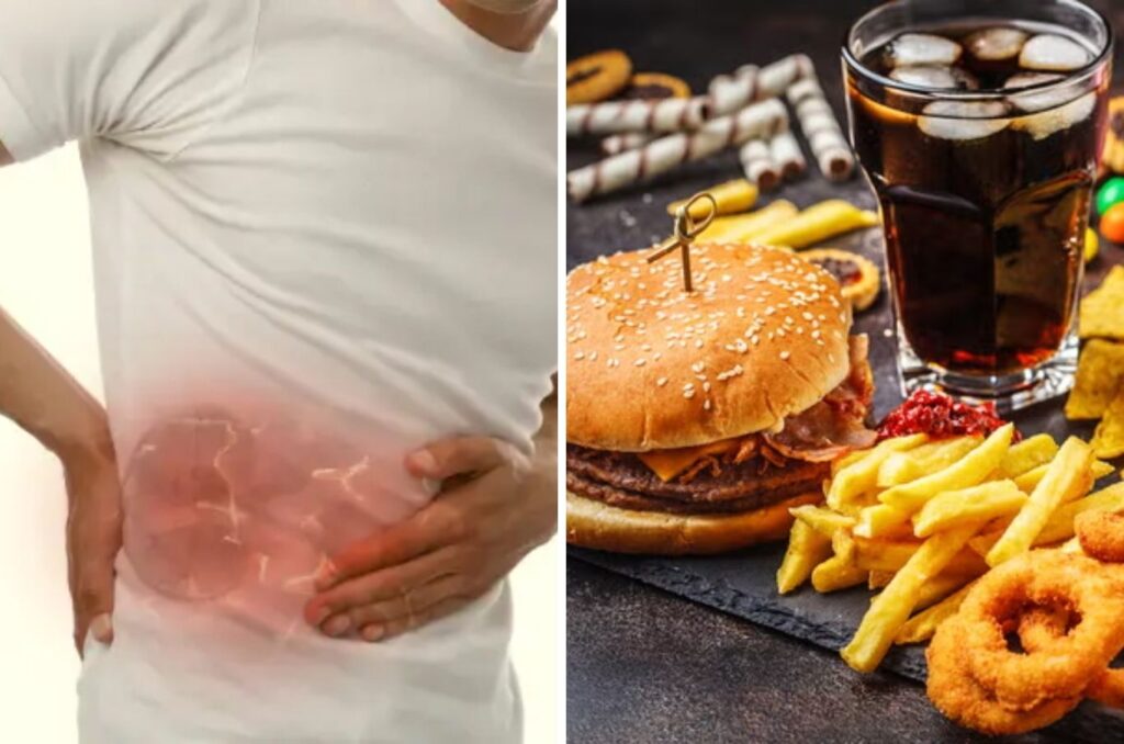 Delicious but Silent Killers: These Foods Are Quietly Making Your Kidneys Sick