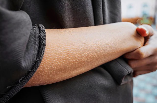 Why Do Goosebumps Appear and Disappear? The Science Behind This Strange Skin Reaction